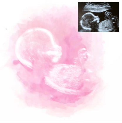 Baby Scan Ink New Baby Scan | Keepsake Print – DCPDESIGNS
