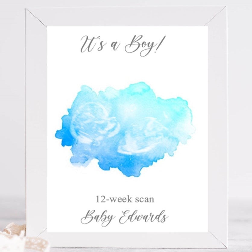 New Baby Scan | Keepsake Print