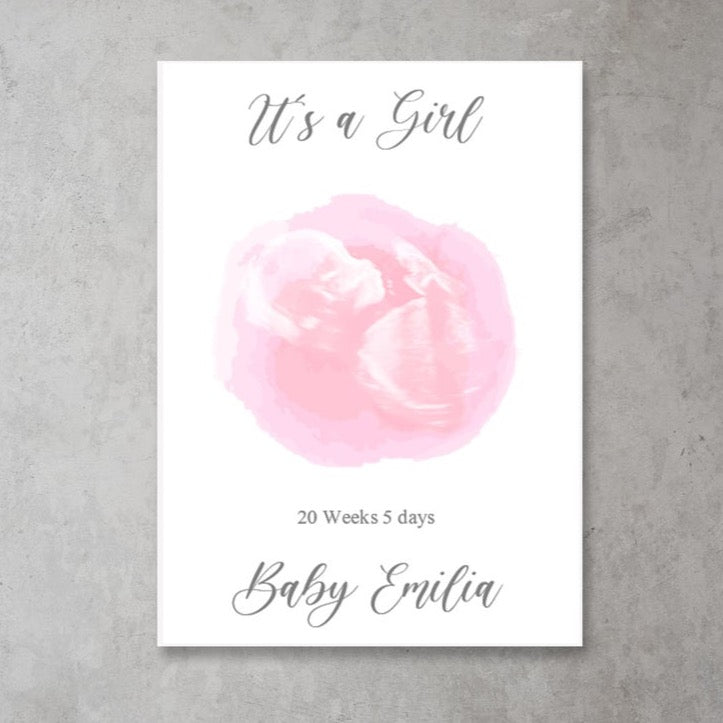 New Baby Scan | Keepsake Print